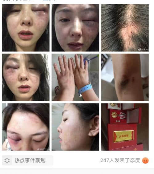 女子西昌旅游被打经过始末 女游客为何被同事朋友殴打